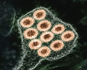 rabies.png