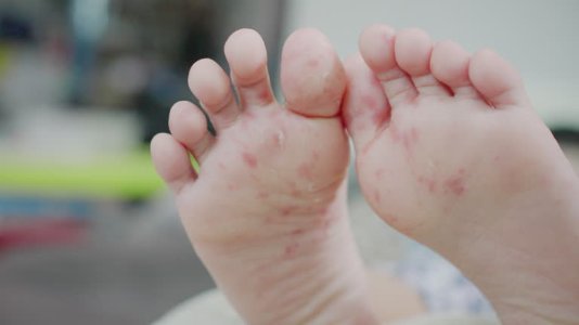 gettyimages-2173770751-640x640.jpg